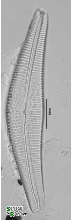Cymbella