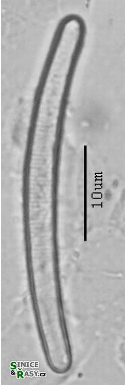 Eunotia bilunaris