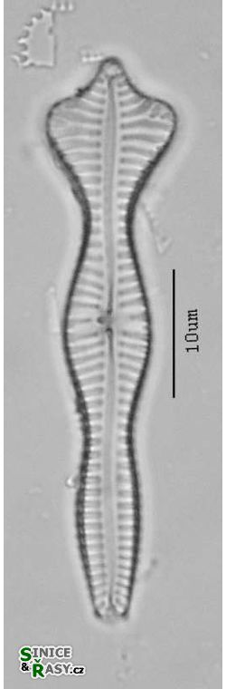 Gompohonema acuminatum
