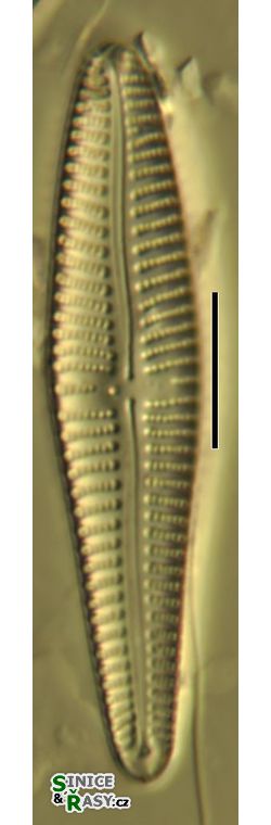 Gomphonema