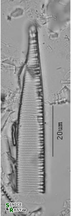 Hantzschia