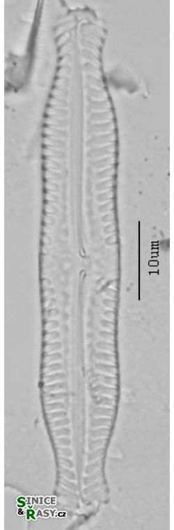 Pinnularia nodosa
