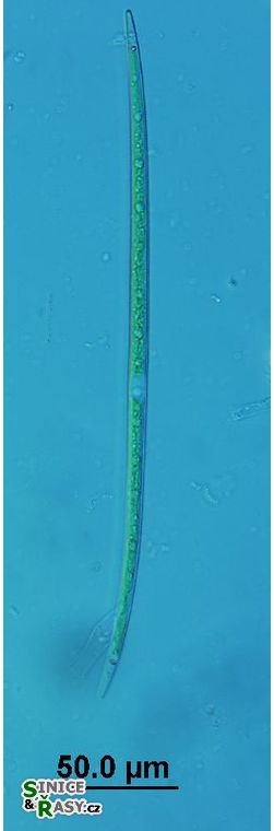 Closterium limneticum