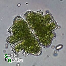 Euastrum verrucosum