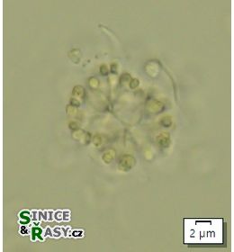 Snowella lacustris