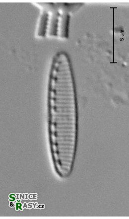 Nitzschia