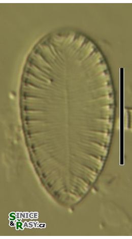 Surirella brebissoni