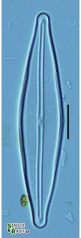 Frustulia saxonica