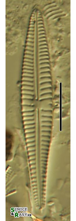 Gomphonema angustatum