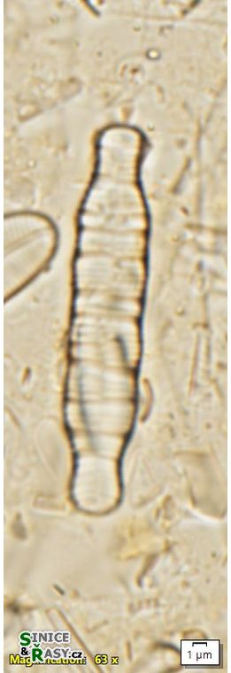 Odontidium anceps