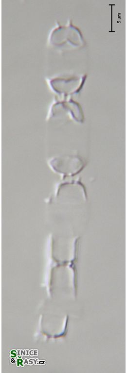 Skeletonema potamos