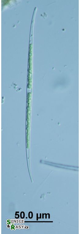 Closterium limneticum