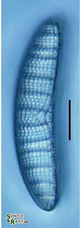 Epithemia adnata