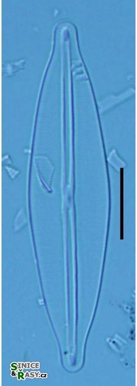 Frustulia crassinervia