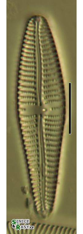 Gomphonema