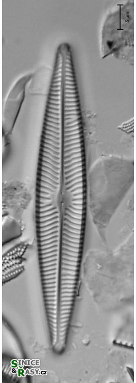 Navicula radiosa