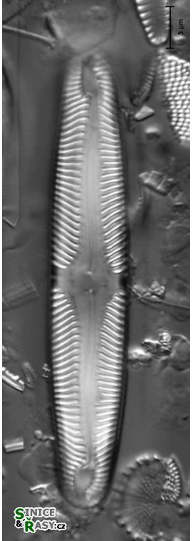 Pinnularia microstauron