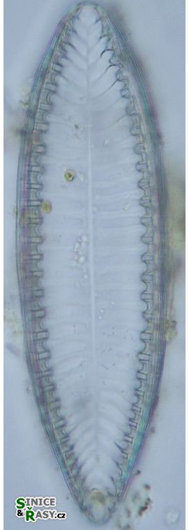 Surirella