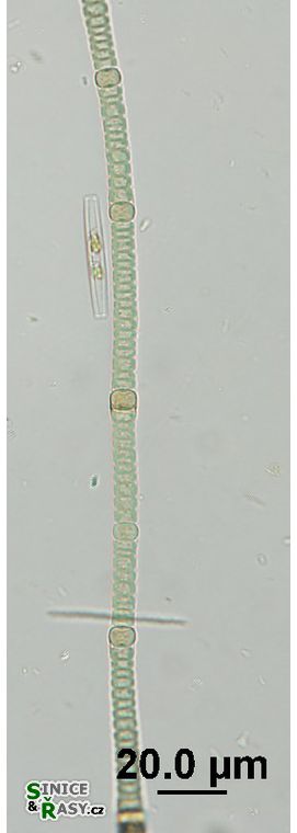 Nodularia harveyana