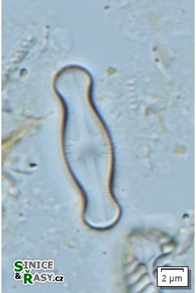 Sellaphora medioconvexa