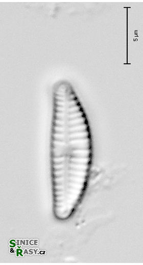 Encyonema perpusillum