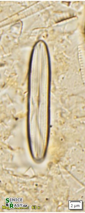 Neidium alpinum