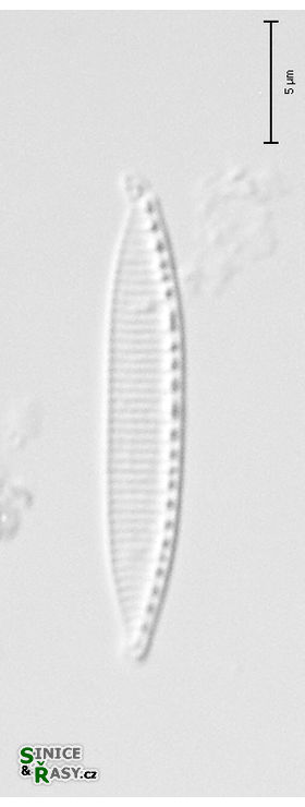 Nitzschia frustulum