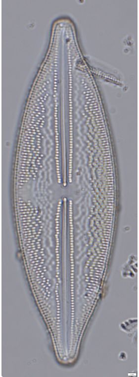 Anomoeoneis sphaerophora