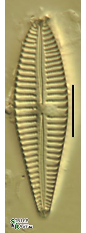 Gomphonema affine