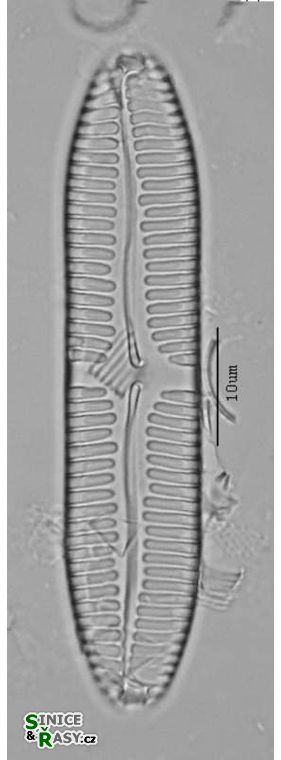 Pinnularia complexa