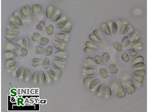 Gomphosphaeria semen-vitis