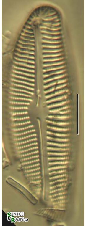 Encyonema prostratum