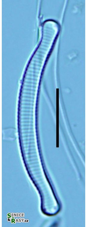 Eunotia arculus