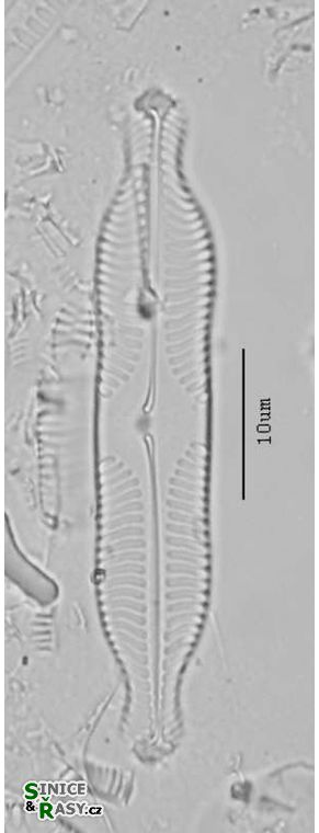 Pinnularia grunowii