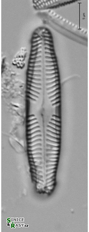 Pinnularia microstauron