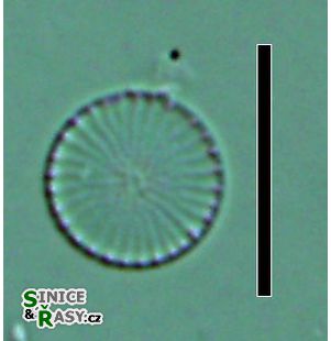 Cyclostephanos invisitatus