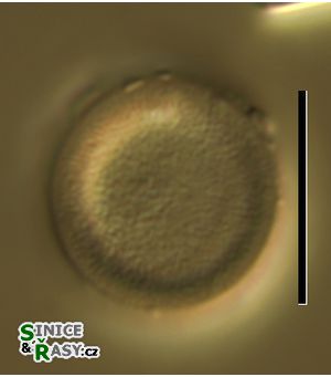 Melosira dickiei