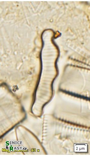 Eunotia paratridentula