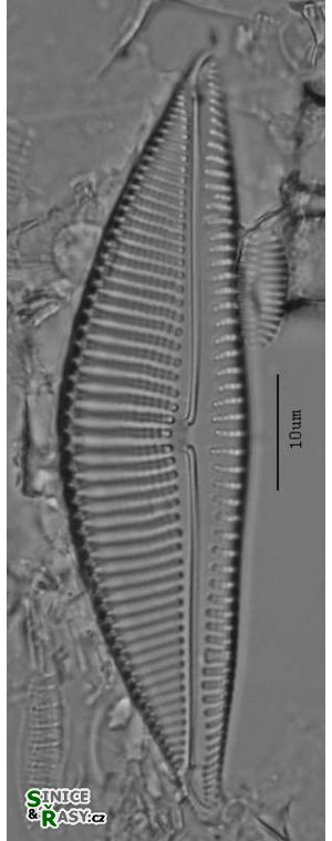 Encyonema elginense