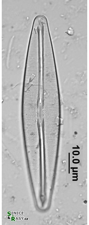 Frustulia saxonica