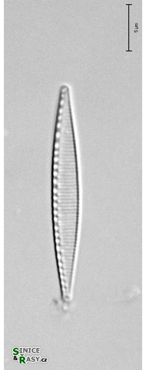 Nitzschia cf. liebertruthii