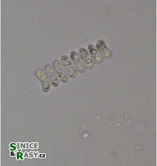 Scenedesmus ellipticus