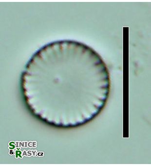Cyclotella atomus