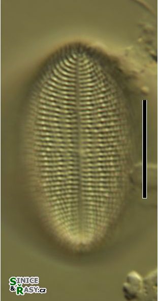 Cocconeis pediculus