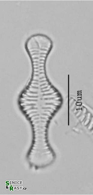 Tabellaria flocculosa