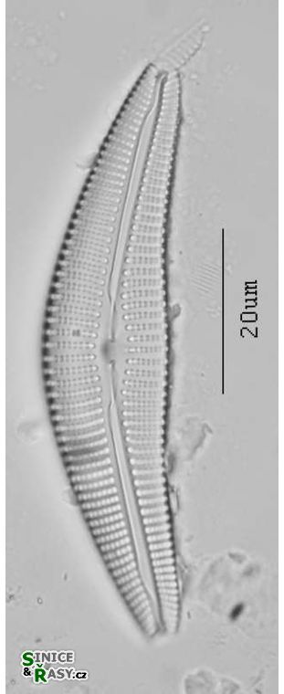 Cymbella
