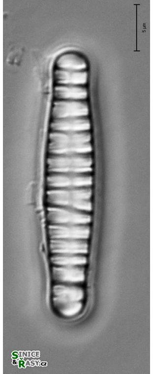 Diatoma