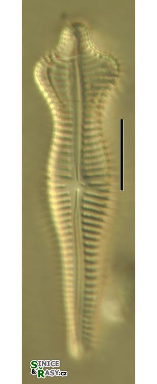 Gomphonema acuminatum