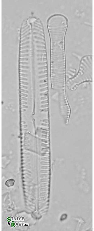 Pinnularia