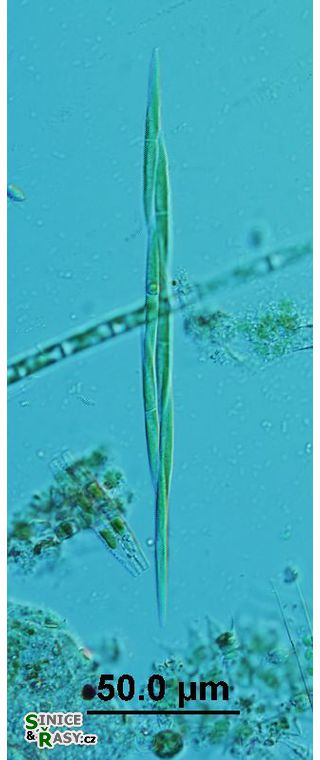 Monoraphidium griffithii